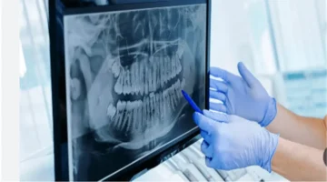برامج تدريب الأشعة من وزارة الصحة تحدد شروط التقديم وآليات الالتحاق للمختصين